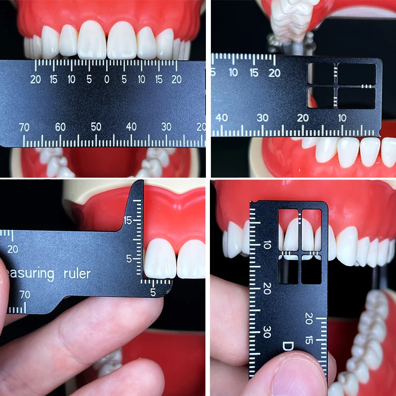 Photography Rules - Autoclavable Dental Precision Teeth Measuring Ruler